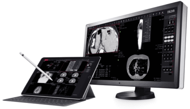 aycan universal thin client viewers HTML5 FDA cleared