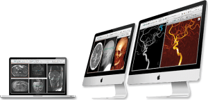 aycan workstation DICOM viewer FDA cleared key benefits
