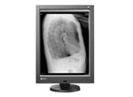 aycan EIZO Radiforce GX240 diagnostic monitor for radiology
