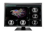 aycan EIZO Radiforce RX660 diagnostic monitor for radiology