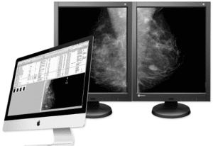 aycan mammography workstation iMac EIZO