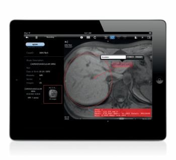 aycan mobile ipad app for radiology