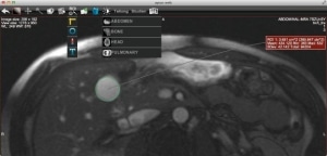 aycan web DICOM viewer for referring physicians