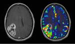 aycan workstation imaging biometrics neuro plug-in