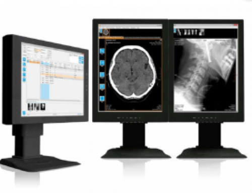 iQ IMAGE Chosen to Update One of the Largest PACS in Latin Americasale and growing relationship with aycan expanding combined footprint in the region